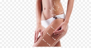 Weight loss Fat Liposuction Woman - Female Weight Loss Photos 