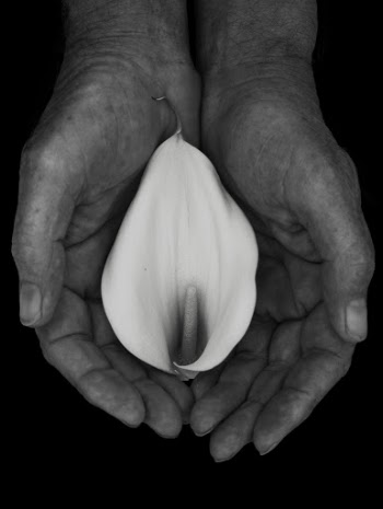 White Anthurium
