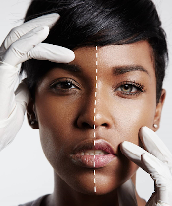 Why it's time all African countries took a stand on skin ...
