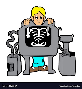 x-ray