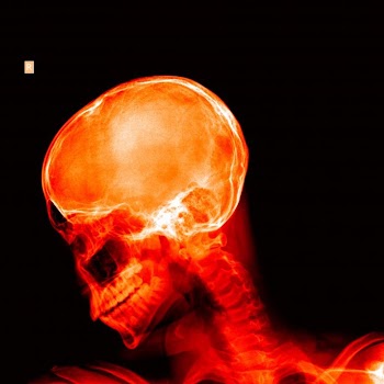 X-ray of a skull - Red on black
