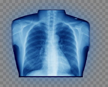 X-Ray PNG Free Download