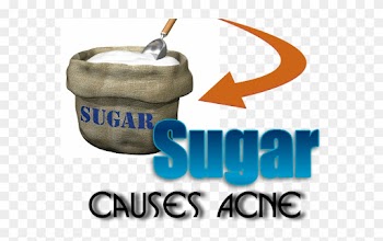 You Have Probably Heard The Ongoing Debate As To Whether - Sugar Act Of 1764