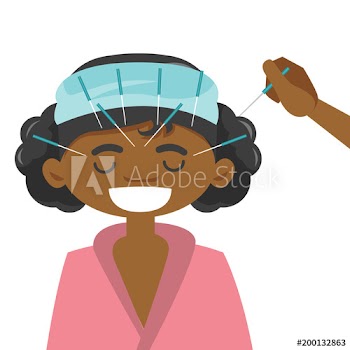 Young african-american woman getting acupuncture treatment in the spa