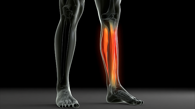 Anatomical Visualization of Lower Legs with Inflammation Effect